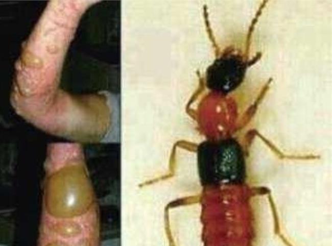 太阳成集团tyc7111cc